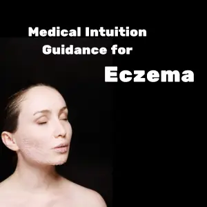 Medical Intuition Guidance for Eczema